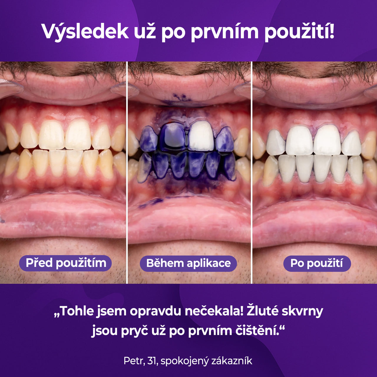 Bělicí korektor V34